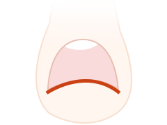 정상