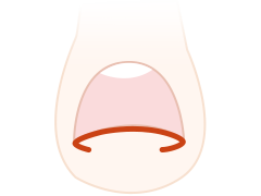 재생 세포