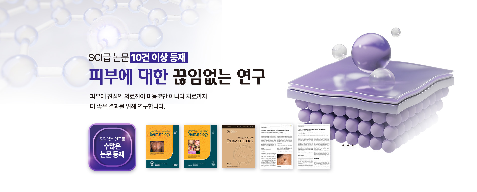 3D 필러
